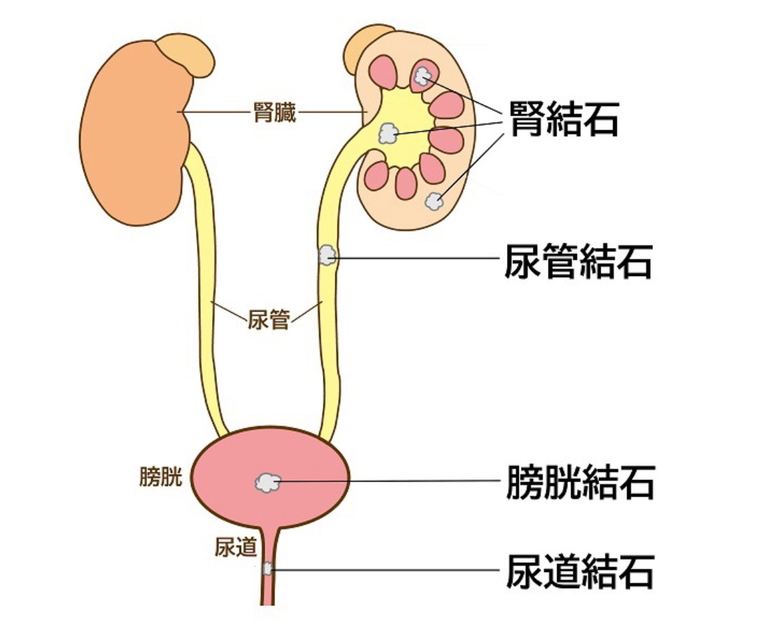 内臓由来の腰痛